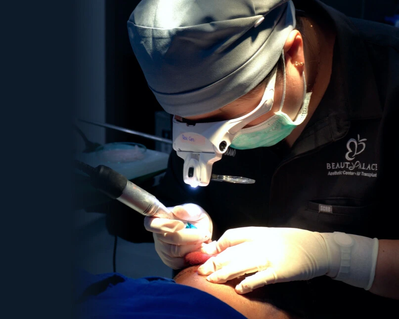 Jakarta Hair Transplant