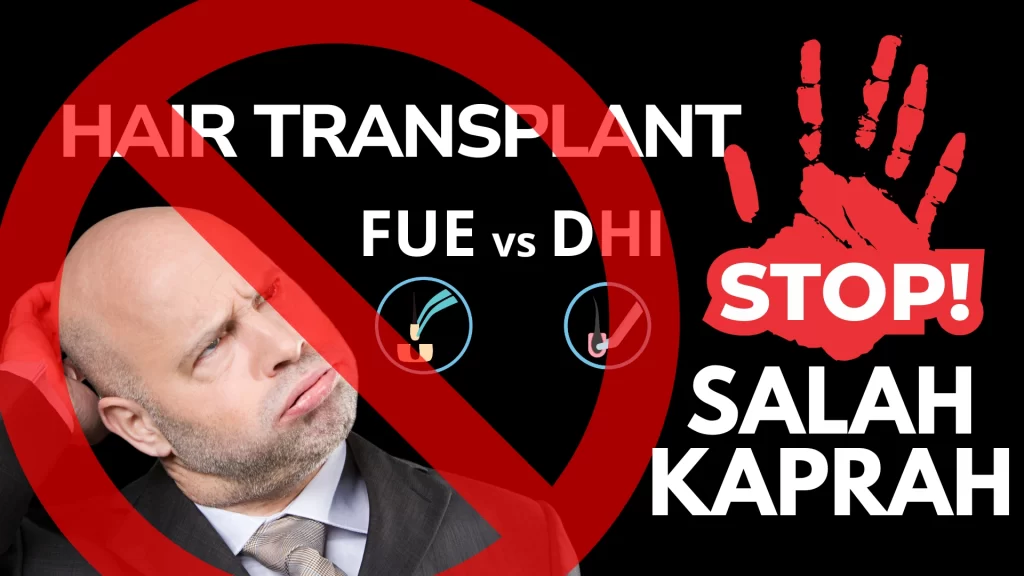 FUE vs DHI misconception salah kaprah