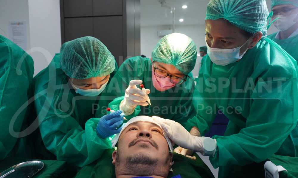 Harga Hair Transplant di Jakarta